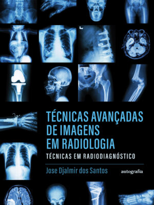 Técnicas avançadas de imagens em radiologia: técnicas em radiodiagnóstico